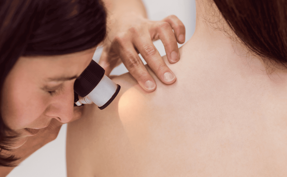 Lo que la crioterapia puede hacer por tu piel