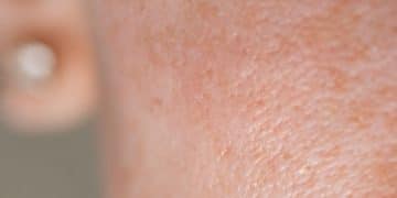 minimizar los poros de la piel